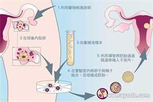 贵阳哪能做供精试管,贵州兴义市在哪里能做助孕试管婴儿？
