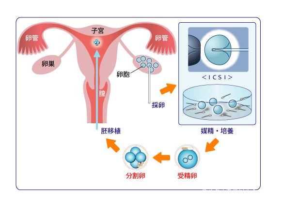 西安辅助生殖费用比较：避免把违法套餐当成医疗报价