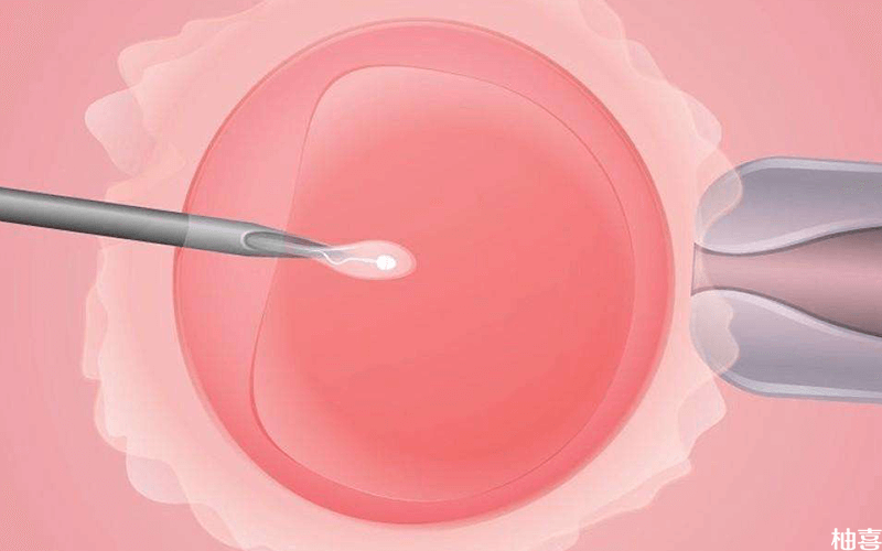 子宫因素影响妊娠怎么办：西安规范评估与治疗思路